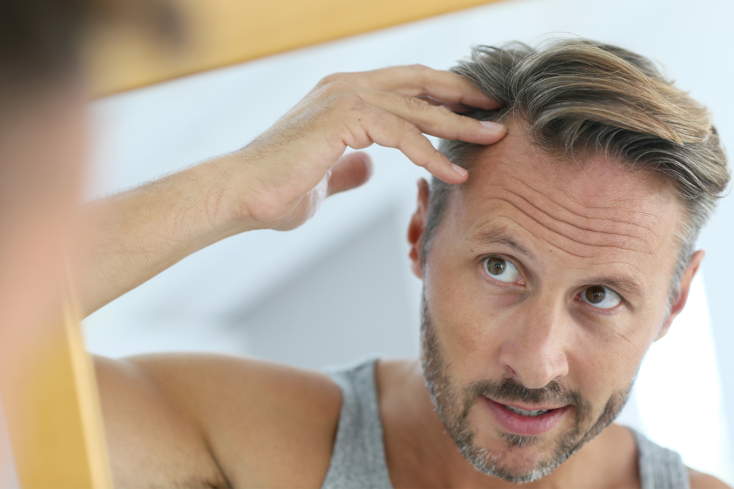 Saw Palmetto Benefits: Does It Reverse Hair Loss?