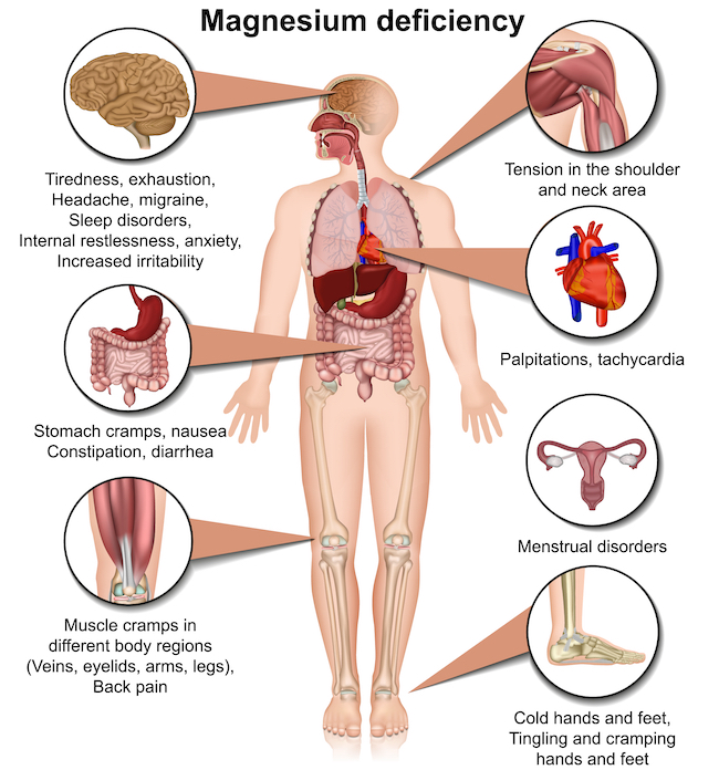 magnesium deficiency symptoms chart